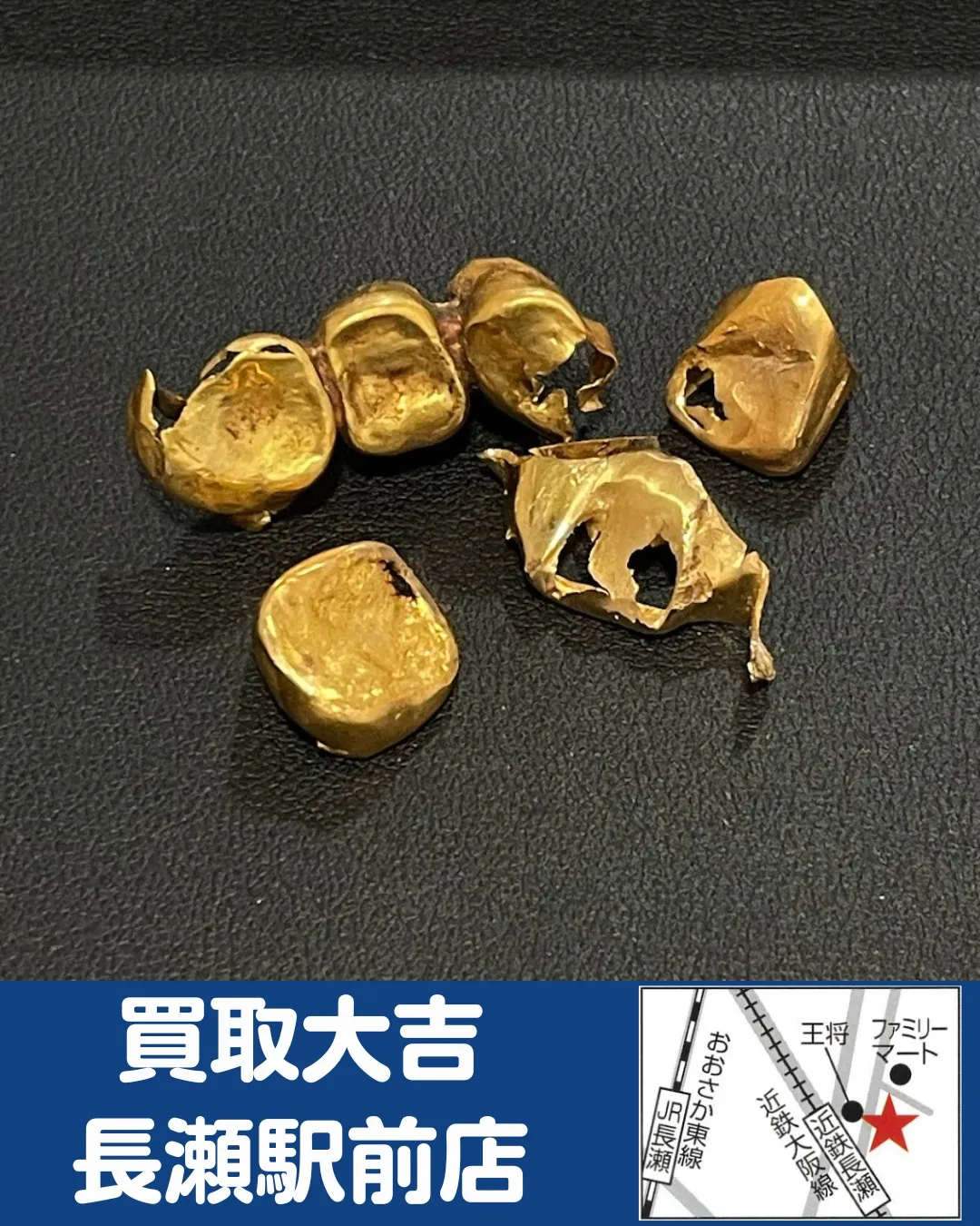 【貴金属】金歯【買取実績】
